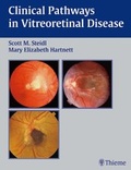 Cover: Clinical Pathways In Vitreoretinal Disease - Thieme Publishers