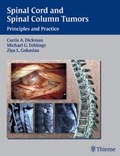 Cover: Spinal Cord and Spinal Column Tumors - Thieme Publishers
