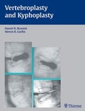Cover: Vertebroplasty and Kyphoplasty - Thieme Publishers