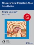 Cover: Neuro-Oncology - Thieme Publishers