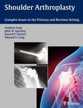 Cover: Shoulder Arthroplasty - Thieme Publishers