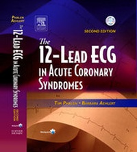 Abbildung von: The 12 Lead ECG in Acute Coronary Syndromes - Mosby