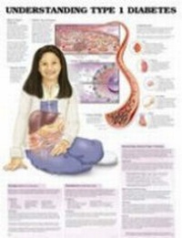 Abbildung von: Understanding Type 1 Diabetes Chart - Anatomical Chart Co.
