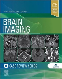 Enlarge image Cover: Brain Imaging - Elsevier