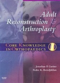 Cover: Core Knowledge in Orthopaedics: Adult Reconstruction and Arthroplasty - Mosby