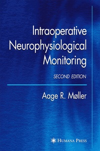 Enlarge image Cover: Intraoperative Neurophysiological Monitoring - Humana