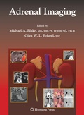 Cover: Adrenal Imaging - Humana