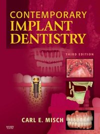 Abbildung von: Contemporary Implant Dentistry - Mosby