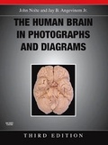 Cover: The Human Brain in Photographs and Diagrams - Mosby