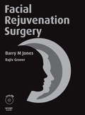 Cover: Facial Rejuvenation Surgery with DVD - Mosby