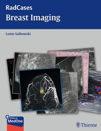 Enlarge image Cover: Radcases Breast Imaging - Thieme Publishers