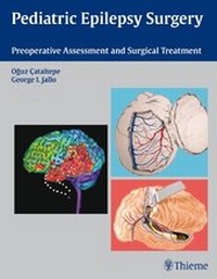 Abbildung von: Pediatric Epilepsy Surgery - Thieme Publishers