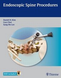 Abbildung von: Endoscopic Spine Procedures - Thieme Publishers