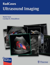 Enlarge image Cover: Radcases Ultrasound Imaging - Thieme Publishers