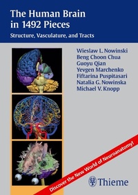 Enlarge image Cover: The Human Brain in 1,492 Pieces - Thieme Publishers