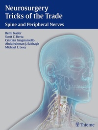 Abbildung von: Neurosurgery Tricks of the Trade - Thieme Publishers