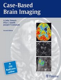 Enlarge image Cover: Case-Based Brain Imaging - Thieme Publishers
