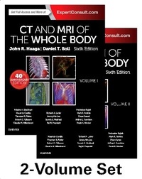 Abbildung von: CT and MRI of the Whole Body, 2-Volume Set - Elsevier