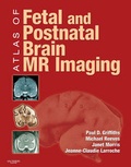 Cover: Atlas of Fetal and Infant Brain MR - Elsevier