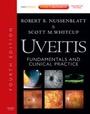 Cover: Uveitis - Mosby