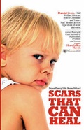 Cover: Scars That Can Heal - Booklocker Inc.,US