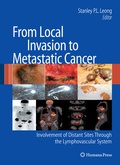 Cover: From Local Invasion to Metastatic Cancer - Humana