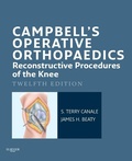 Cover: Campbell's Operative Orthopaedics: Reconstructive Procedures of the Knee E-Book - Mosby