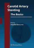 Cover: Carotid Artery Stenting: The Basics - Humana