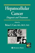 Cover: Hepatocellular Cancer - Humana Press Inc.