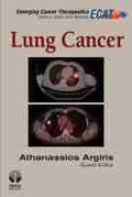 Cover: Lung Cancer - Demos Medical Publishing