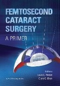 Cover: Femtosecond Cataract Surgery - SLACK  Incorporated
