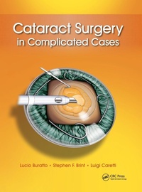 Abbildung von: Cataract Surgery in Complicated Cases - SLACK  Incorporated