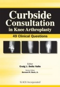 Abbildung von: Curbside Consultation in Knee Arthroplasty - Slack
