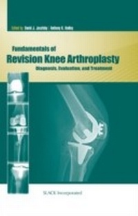 Abbildung von: Fundamentals of Revision Knee Arthroplasty - Slack
