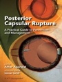 Cover: Posterior Capsular Rupture - SLACK Incorporated