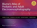 Cover: Blume's Atlas of Pediatric and Adult Electroencephalography - Lippincott Williams and Wilkins