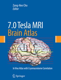 Abbildung von: 7.0 Tesla MRI Brain Atlas - Springer