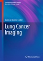Cover: Lung Cancer Imaging - Humana