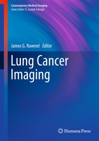 Enlarge image Cover: Lung Cancer Imaging - Humana