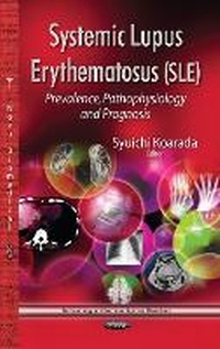 Enlarge image Cover: Systemic Lupus Erythematosus (SLE) - Nova Science Publishers Inc