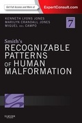 Bild: Smith's Recognizable Patterns of Human Malformation - Saunders
