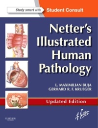 Abbildung von: Netter's Illustrated Human Pathology Updated Edition - Saunders