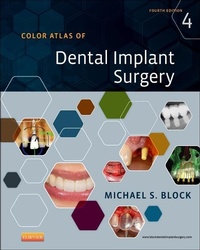 Abbildung von: Color Atlas of Dental Implant Surgery - Saunders