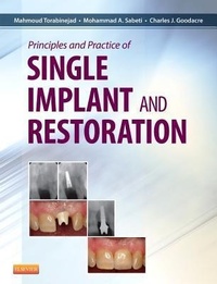 Enlarge image Cover: Principles and Practice of Single Implant and Restoration - Saunders