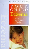 Cover: Eczema - Element Books