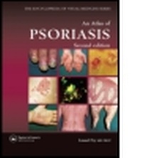 Enlarge image Cover: An Atlas of Psoriasis - Taylor & Francis