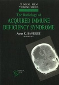 Cover: Radiology of Acquired Immune Deficiency Syndrome - Clinical Press Ltd