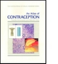 Enlarge image Cover: A Slide Atlas of Contraception - Informa Healthcare