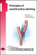 Bild: Principles of Carotid Artery Stenting - UNI-MED Verlag AG
