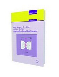 Enlarge image Cover: Interpreting Dental Radiographs - Quintessence Publishing Co Ltd